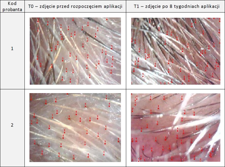 Efekty stosowania Serum do brwi i rzęs